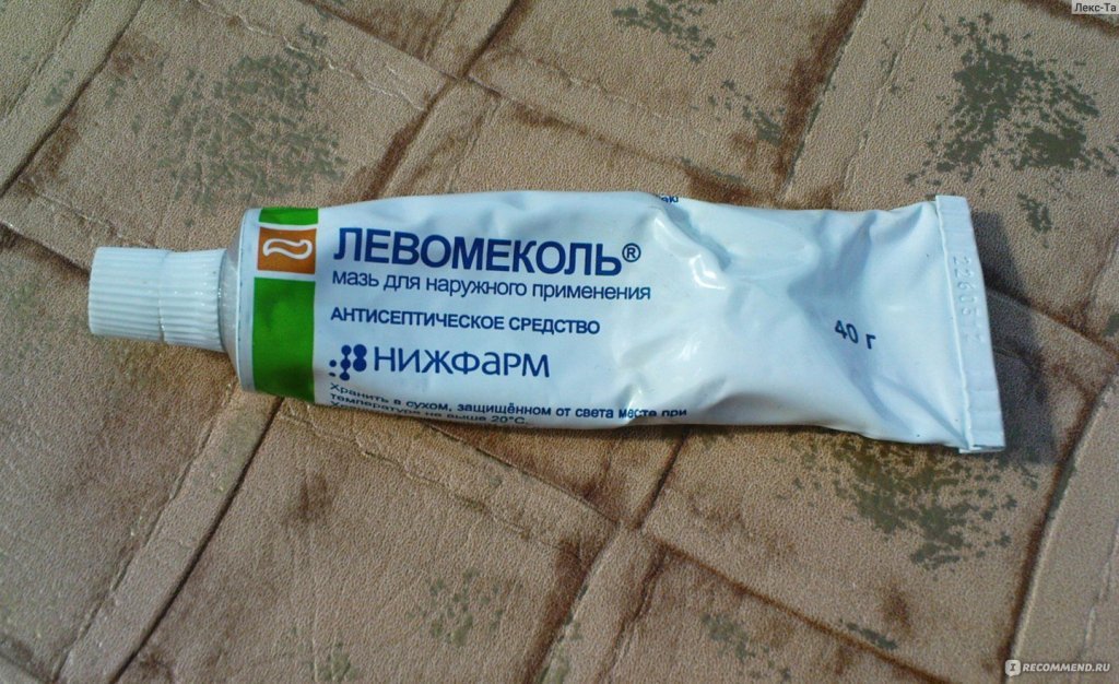 Самая эффективная мазь от вросшего ногтя - обзор средств